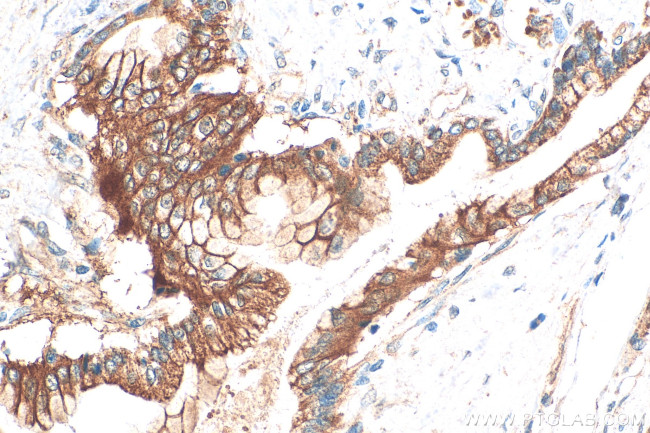 CD164L2 Antibody in Immunohistochemistry (Paraffin) (IHC (P))