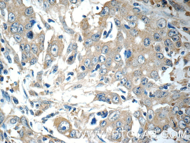 TMEM199 Antibody in Immunohistochemistry (Paraffin) (IHC (P))