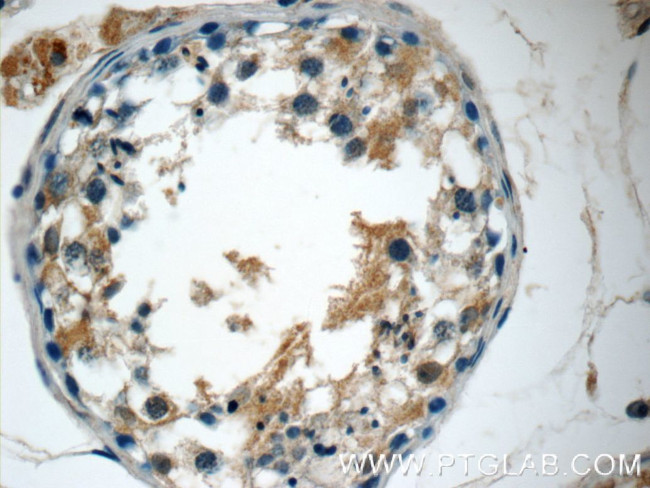 MFSD2 Antibody in Immunohistochemistry (Paraffin) (IHC (P))