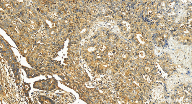 MATN3 Antibody in Immunohistochemistry (Paraffin) (IHC (P))