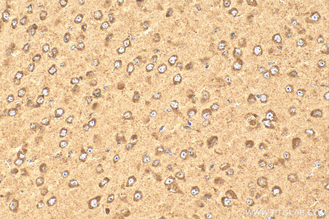 TMEM74 Antibody in Immunohistochemistry (Paraffin) (IHC (P))