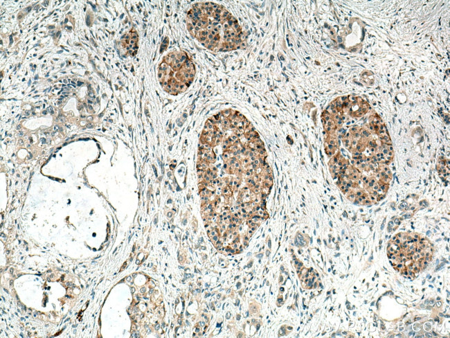 TMEM24 Antibody in Immunohistochemistry (Paraffin) (IHC (P))