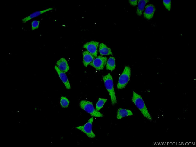C3orf38 Antibody in Immunocytochemistry (ICC/IF)