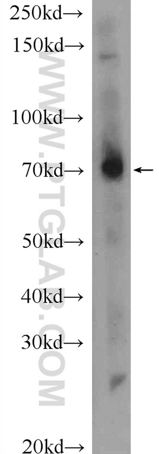 MPZL3 Antibody in Western Blot (WB)