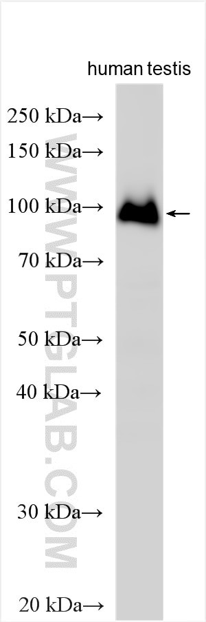GCNA Antibody in Western Blot (WB)