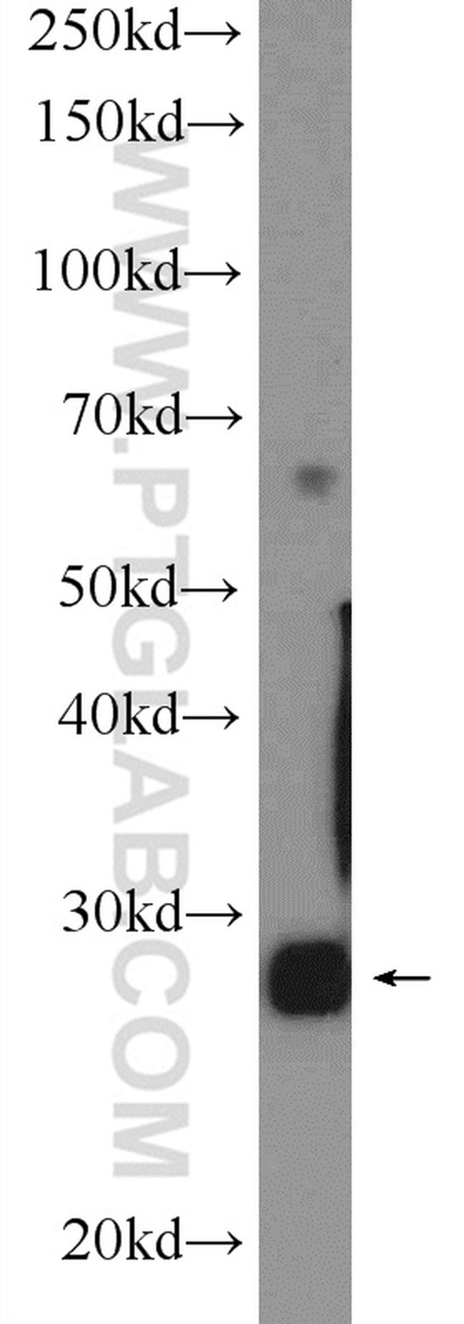 PGAM2 Antibody in Western Blot (WB)