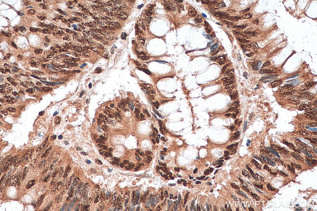 TAF15 Antibody in Immunohistochemistry (Paraffin) (IHC (P))