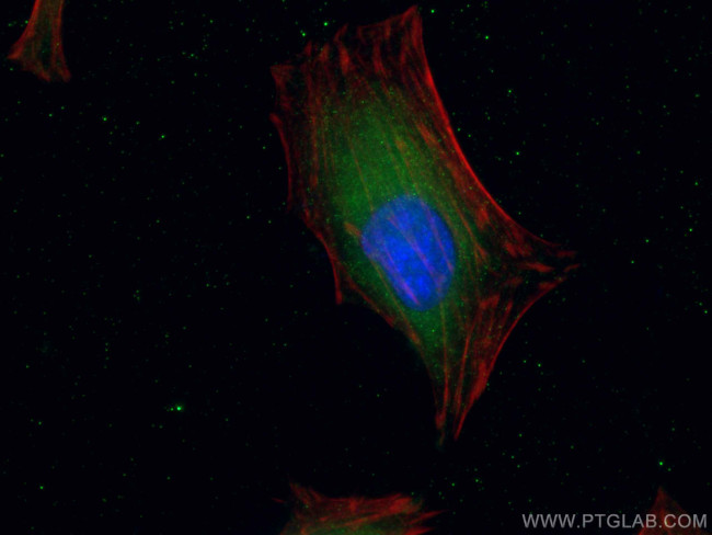 MCP1 Antibody in Immunocytochemistry (ICC/IF)