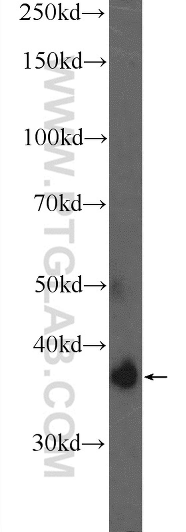 ATRAID Antibody in Western Blot (WB)