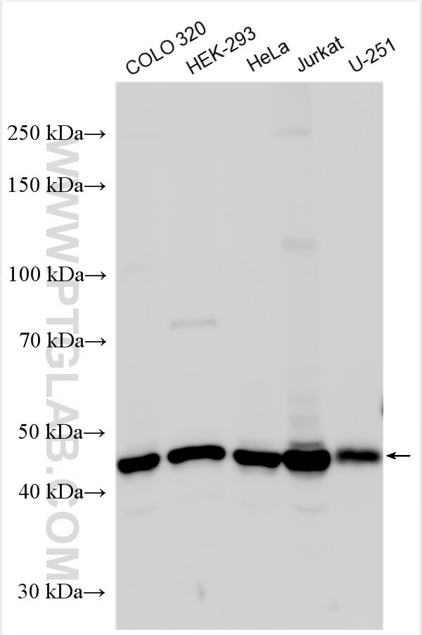 ARMC6 Antibody in Western Blot (WB)