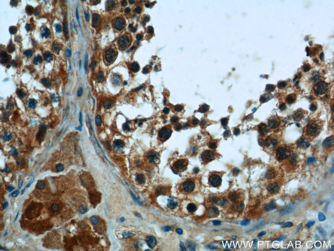 PNLDC1 Antibody in Immunohistochemistry (Paraffin) (IHC (P))