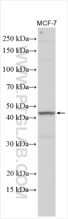 EPHX4 Antibody in Western Blot (WB)