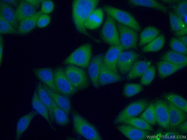 C2orf79/PTRHD1 Antibody in Immunocytochemistry (ICC/IF)