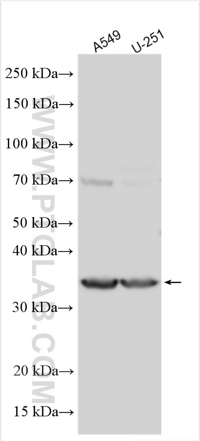 PABPC5 Antibody in Western Blot (WB)