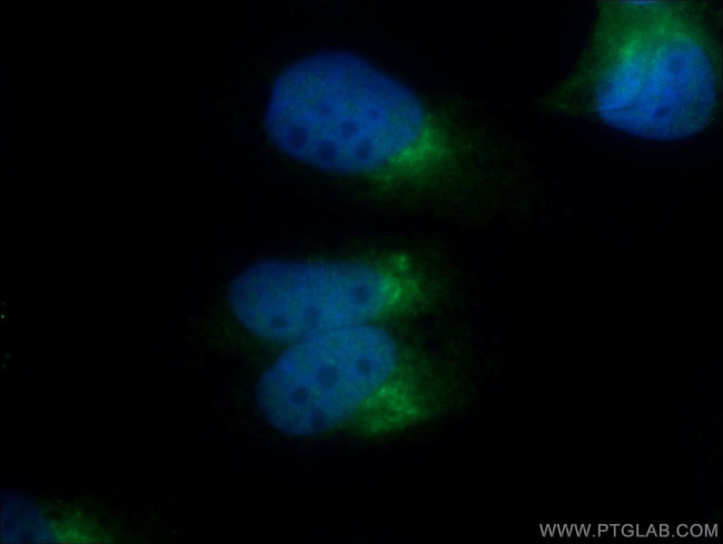 C13orf30 Antibody in Immunocytochemistry (ICC/IF)