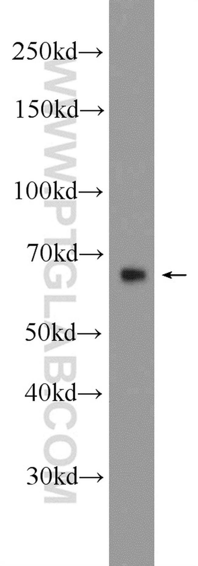 MANSC1 Antibody in Western Blot (WB)
