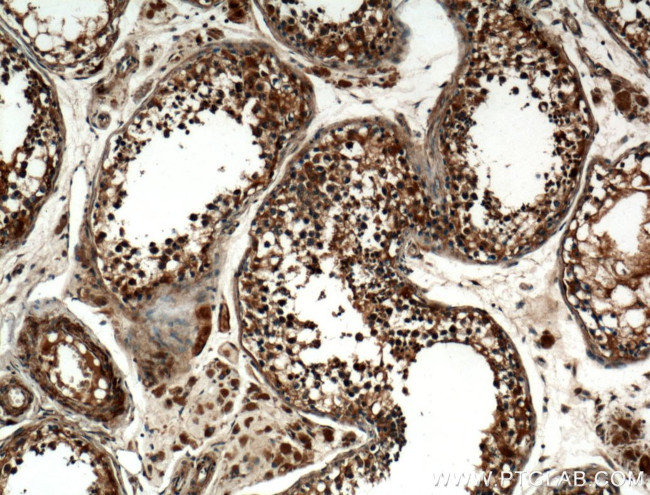 ZMYND12 Antibody in Immunohistochemistry (Paraffin) (IHC (P))