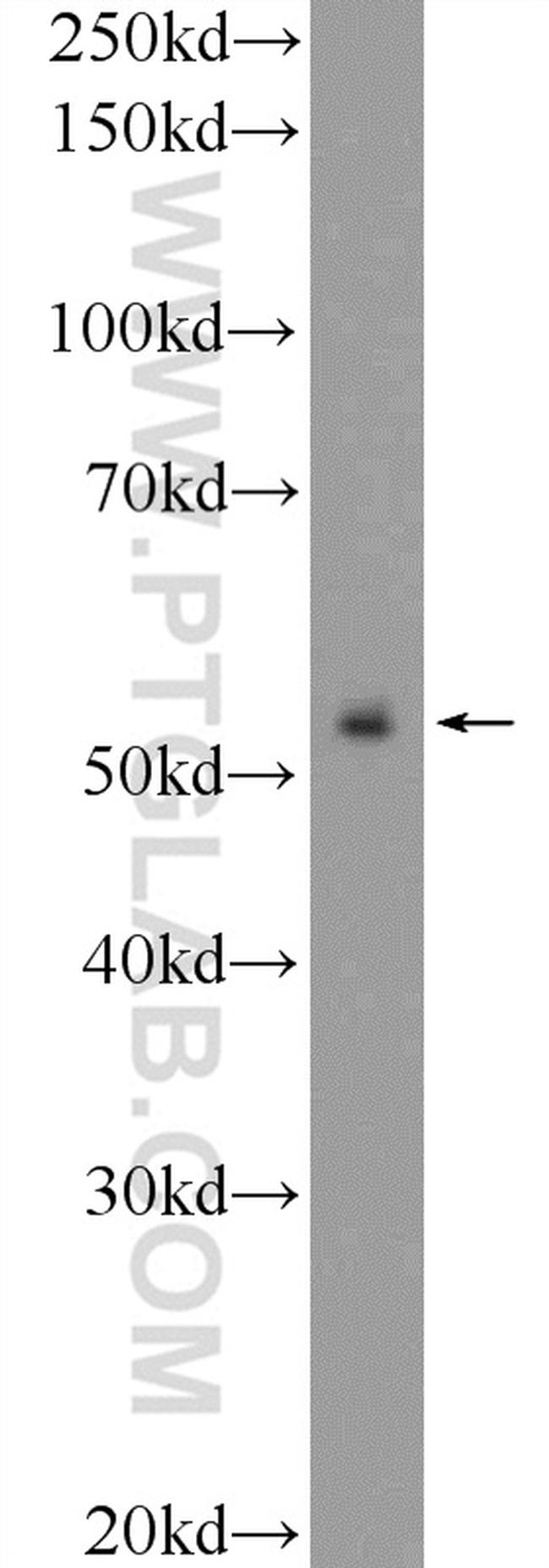 ZNF785 Antibody in Western Blot (WB)