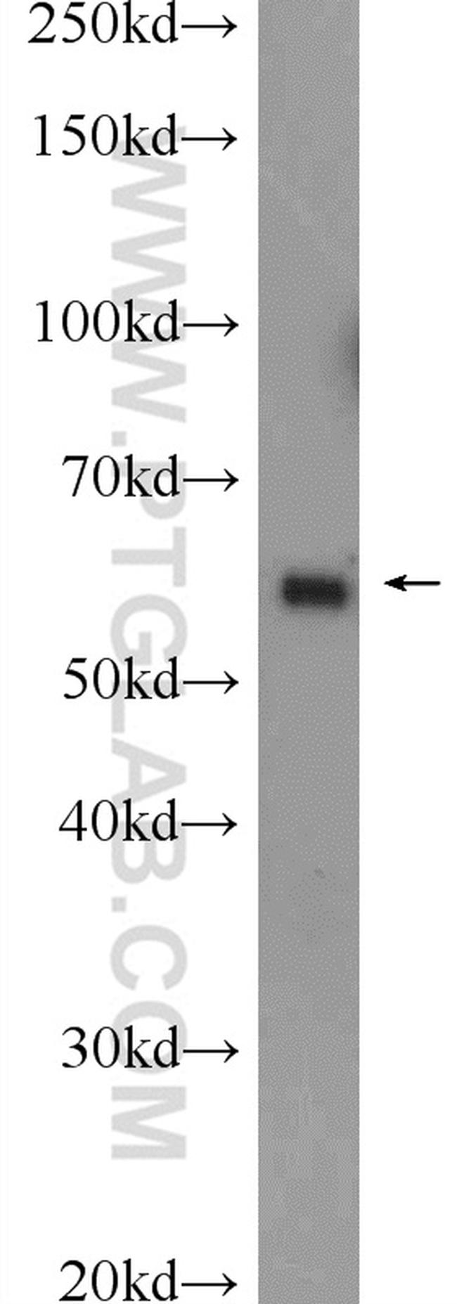 KLHL10 Antibody in Western Blot (WB)