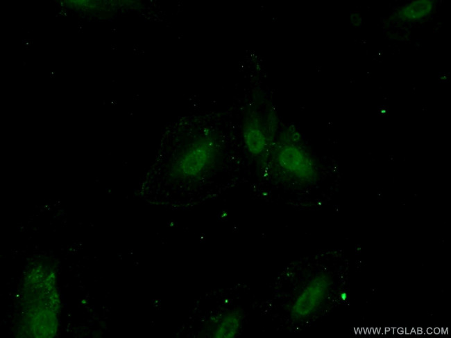 ZNF549 Antibody in Immunocytochemistry (ICC/IF)