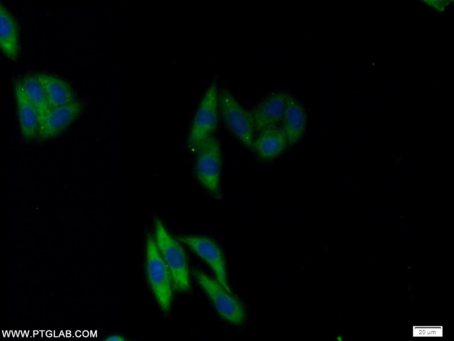 NFU1 Antibody in Immunocytochemistry (ICC/IF)