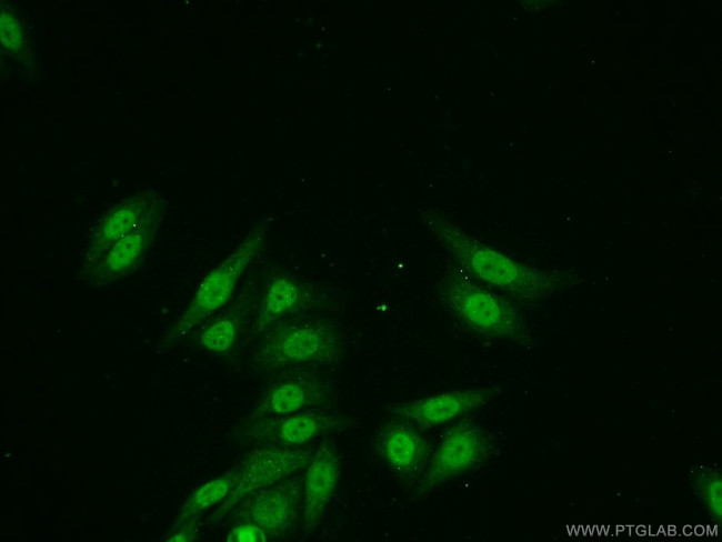ZNF101 Antibody in Immunocytochemistry (ICC/IF)