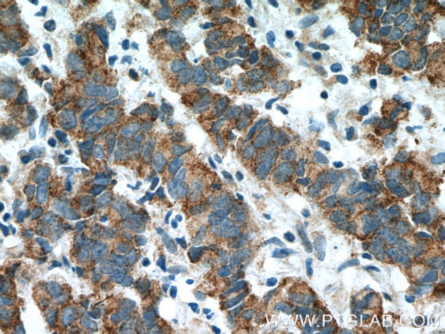 ZNF645 Antibody in Immunohistochemistry (Paraffin) (IHC (P))