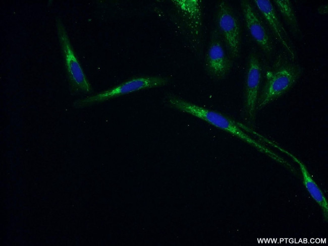 ZNF251 Antibody in Immunocytochemistry (ICC/IF)