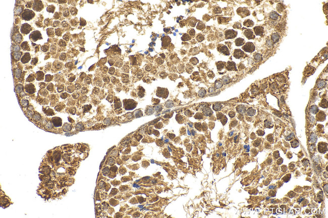 IQUB Antibody in Immunohistochemistry (Paraffin) (IHC (P))
