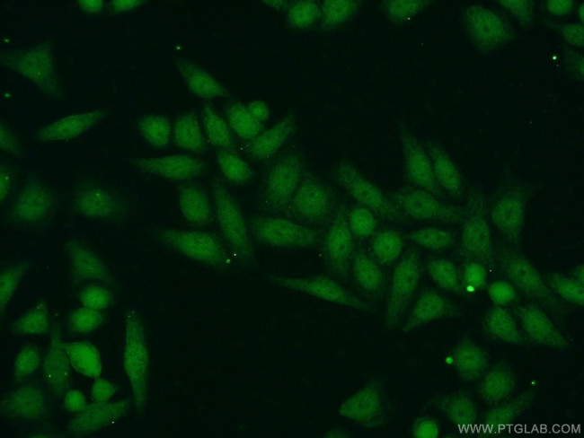 SUPT7L Antibody in Immunocytochemistry (ICC/IF)