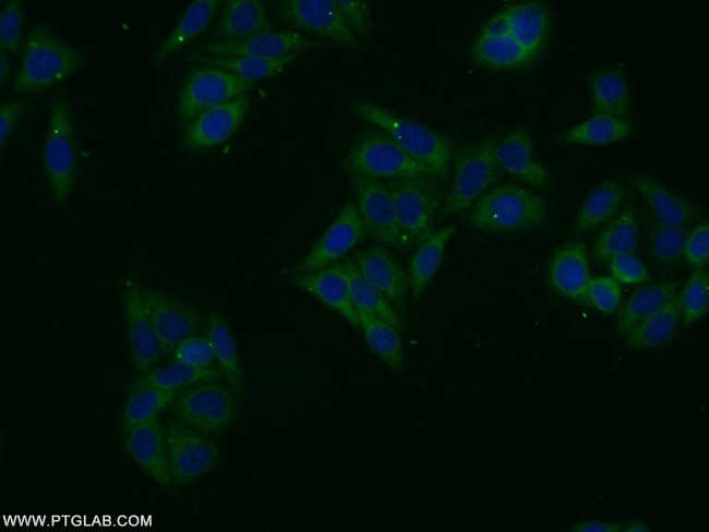 ASB13 Antibody in Immunocytochemistry (ICC/IF)