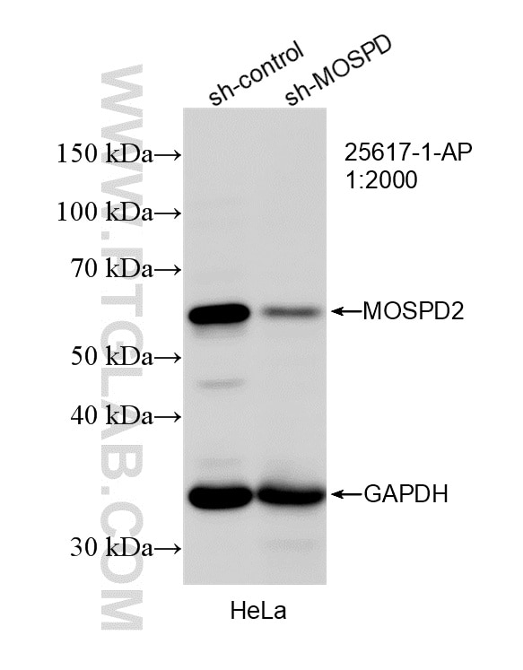 MOSPD2 Antibody in Western Blot (WB)