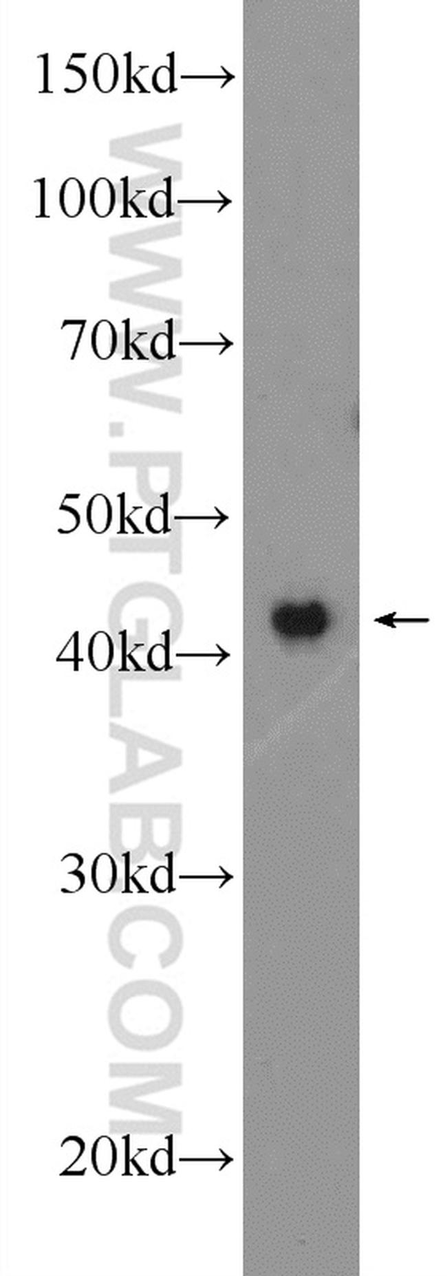 OMCG1 Antibody in Western Blot (WB)