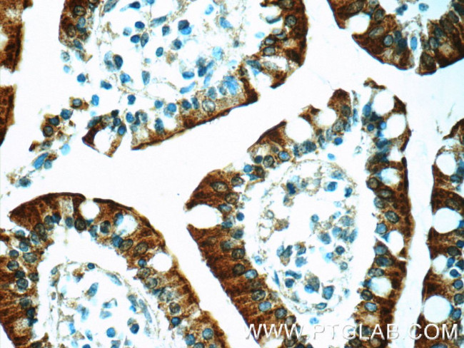 MUPCDH Antibody in Immunohistochemistry (Paraffin) (IHC (P))