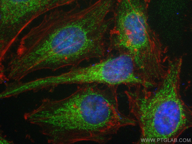 NDUFAF3 Antibody in Immunocytochemistry (ICC/IF)