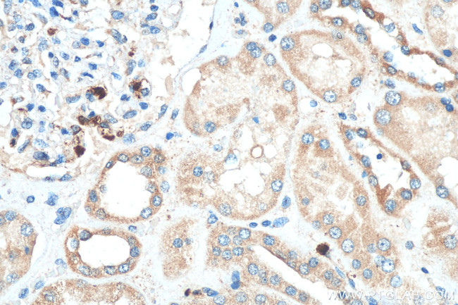KIAA0317 Antibody in Immunohistochemistry (Paraffin) (IHC (P))