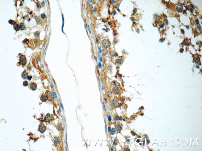 SLC52A3 Antibody in Immunohistochemistry (Paraffin) (IHC (P))