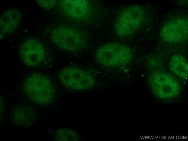 RB1 Antibody in Immunocytochemistry (ICC/IF)