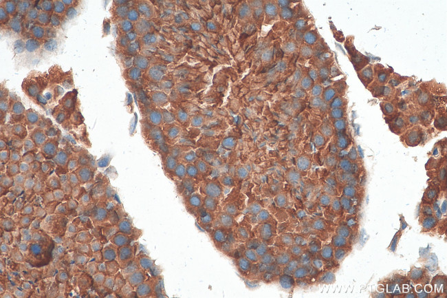 PTPN20A Antibody in Immunohistochemistry (Paraffin) (IHC (P))