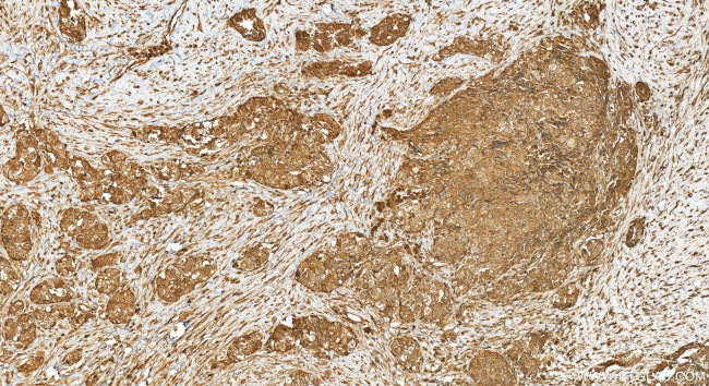 PAN3 Antibody in Immunohistochemistry (Paraffin) (IHC (P))