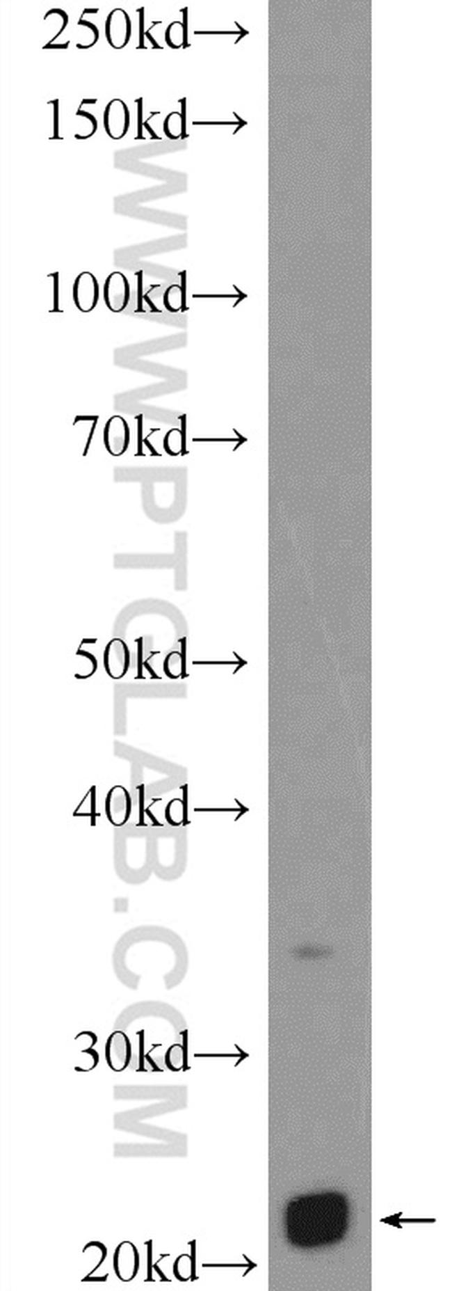 LRRC29 Antibody in Western Blot (WB)