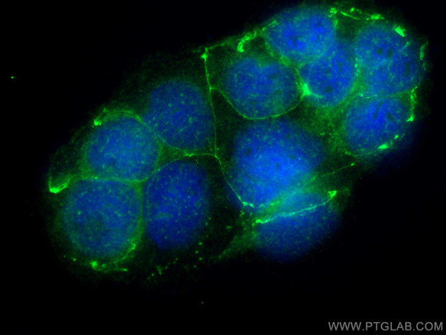 MARVELD3 Antibody in Immunocytochemistry (ICC/IF)
