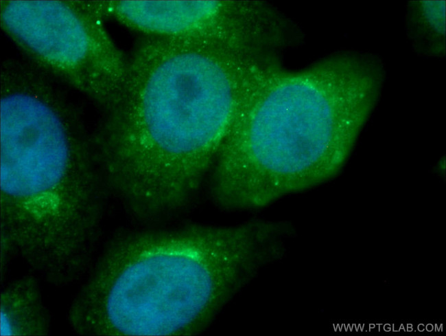 GGA1 Antibody in Immunocytochemistry (ICC/IF)