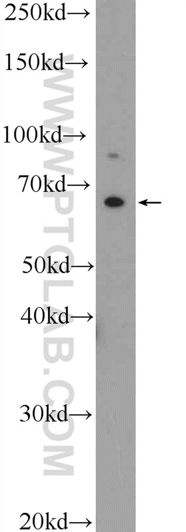 IL1RL2 Antibody in Western Blot (WB)