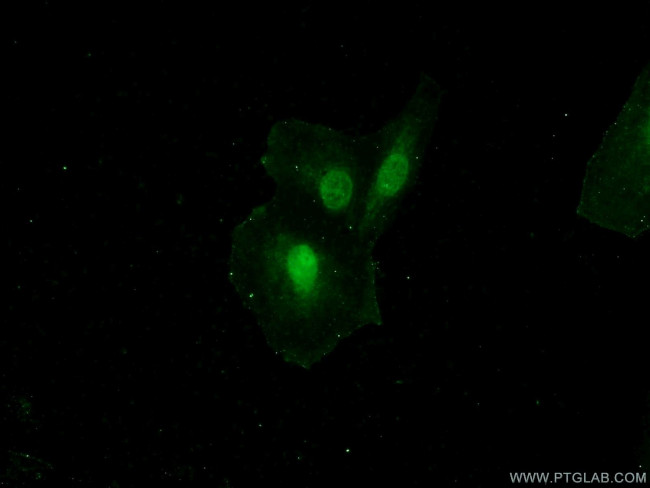GATAD2B Antibody in Immunocytochemistry (ICC/IF)
