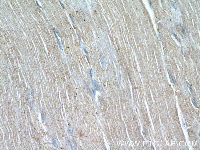 WDR38 Antibody in Immunohistochemistry (Paraffin) (IHC (P))