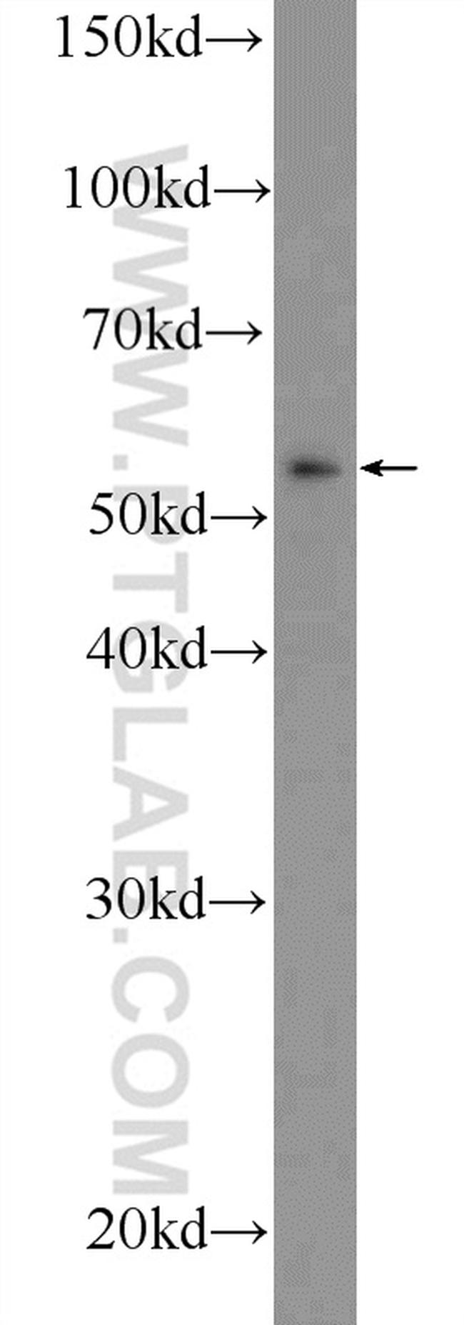 RNFT2 Antibody in Western Blot (WB)
