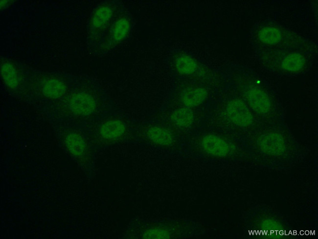 API5 Antibody in Immunocytochemistry (ICC/IF)