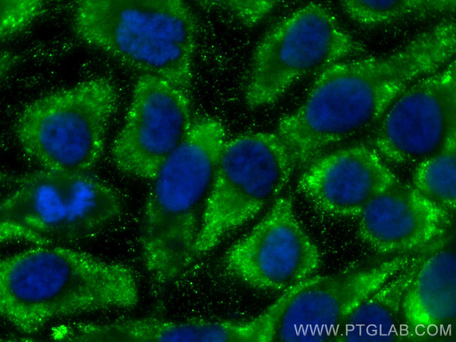 ATAD4/PRR15L Antibody in Immunocytochemistry (ICC/IF)