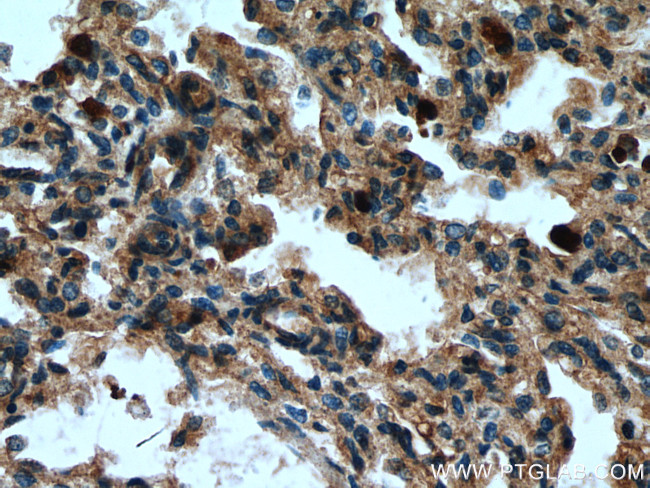 MCEMP1 Antibody in Immunohistochemistry (Paraffin) (IHC (P))